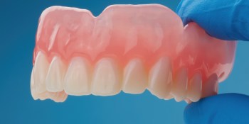 Formlabs will let you 3D print custom teeth for digital dentures